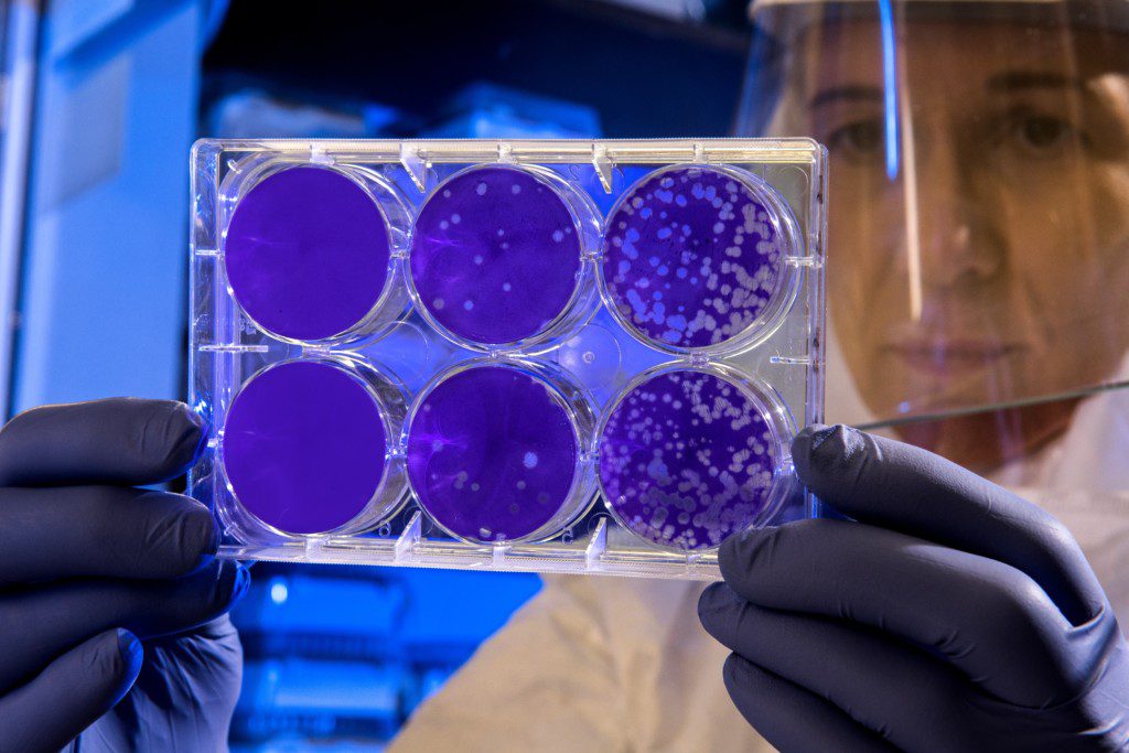 Using UV Light to Kill Bacteria and Mold