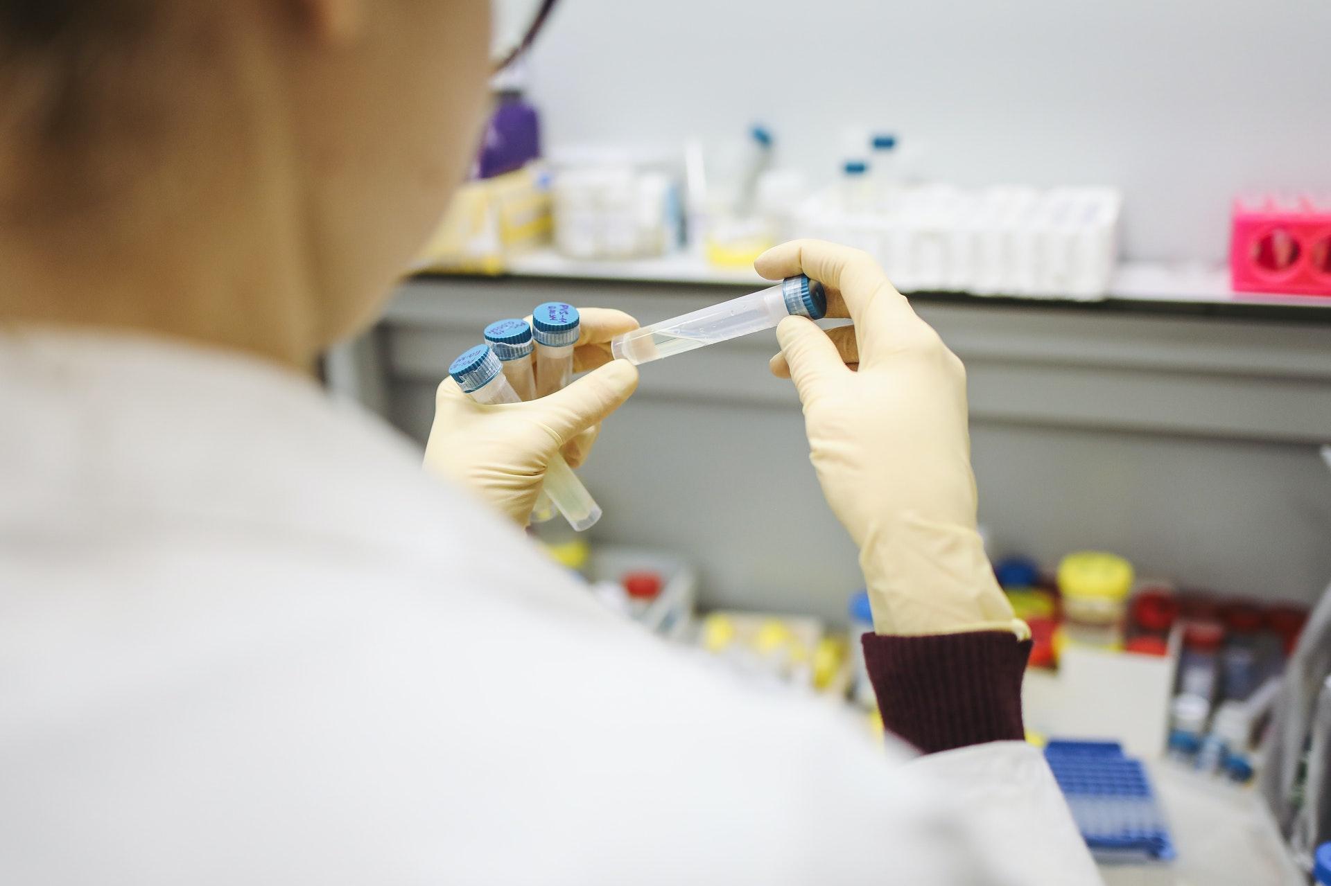 person holding test tubes chemicals